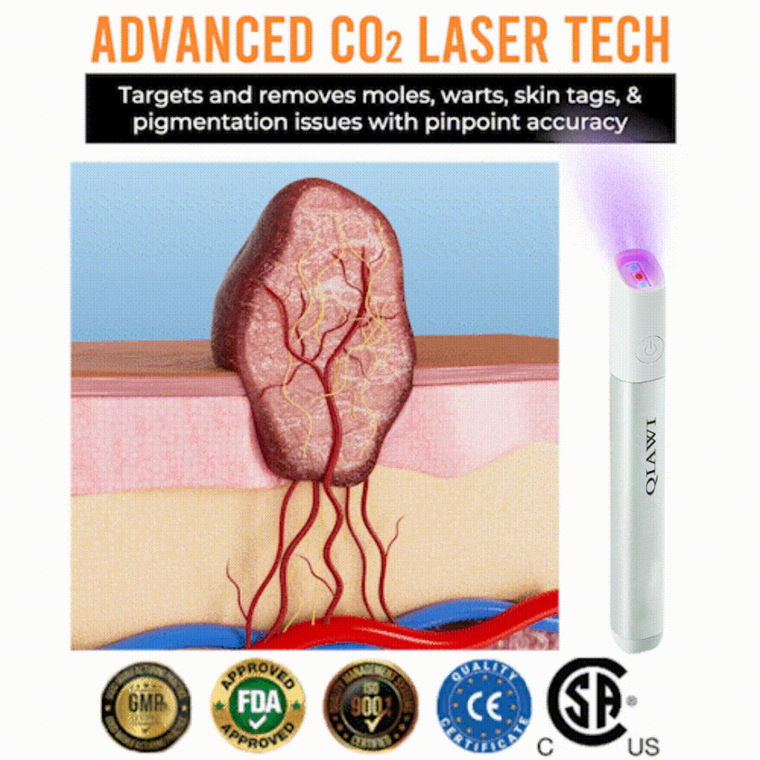 ✨✨Glossy™ All-in-One CO₂ Laser Eraser Pen | Removes Moles, Warts, Skin Flaws & Pigmentation