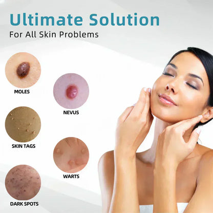 ✨✨Glossy™ All-in-One CO₂ Laser Eraser Pen | Removes Moles, Warts, Skin Flaws & Pigmentation