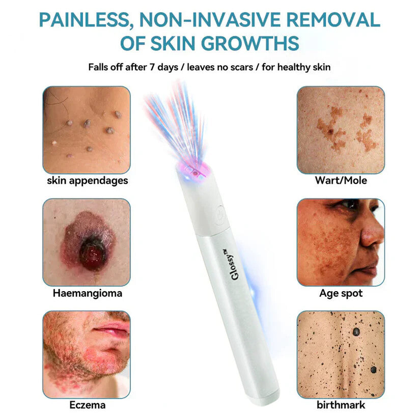 ✨✨Glossy™ All-in-One CO₂ Laser Eraser Pen | Removes Moles, Warts, Skin Flaws & Pigmentation