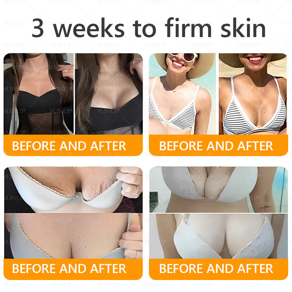 Made and Shipped from USA ✨ VLSVLS® Bee Venom Skin Restoration Cream 🌸 Anti-aging,Hydrating, Skin Repair, Even Tone, Acne and Dark Spot Treatment, Wart and Mole Removal, Psoriasis Relief CS 🔥 LAST DAY 80% OFF 💎