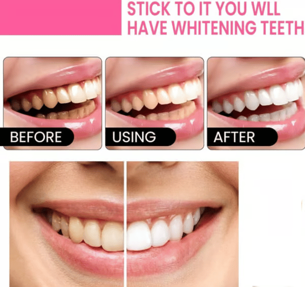 🔥Nicotinamide Probiotic Whitening Toothpaste - Free of Fluoride, Nicotinamide, Anti plaque