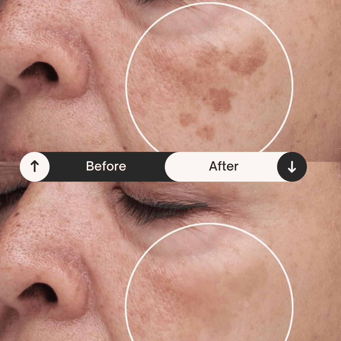 LOVILDS™ Dark Spot Remover for Face and Body