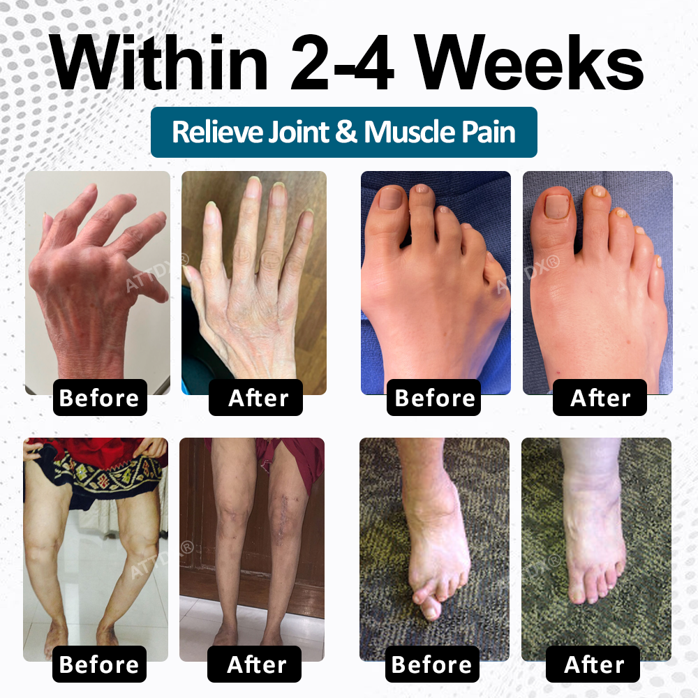 ATTDX® BPC-157 ArthroFlex Motion+ Capsules