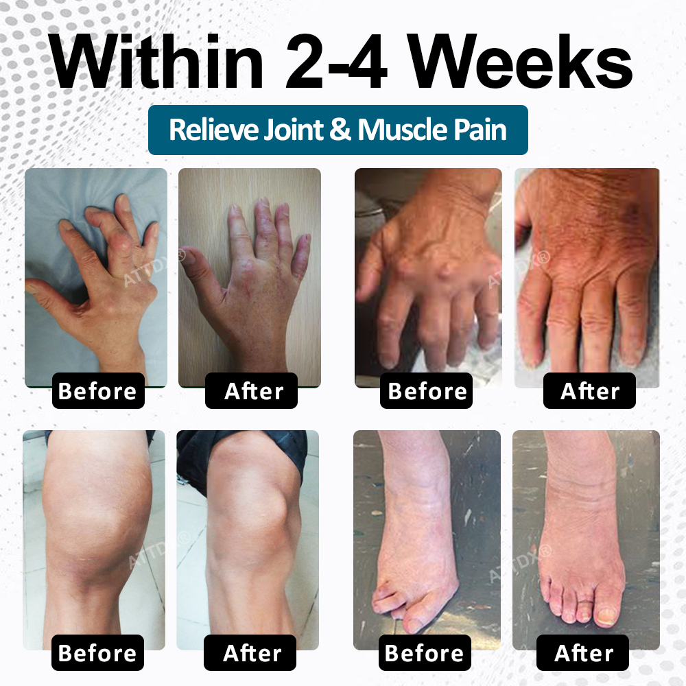 ATTDX® BPC-157 ArthroFlex Motion+ Capsules